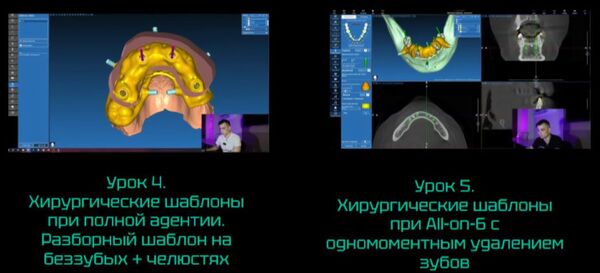 Цифровой курс по хирургическим конструкциям на платформе RealGuide